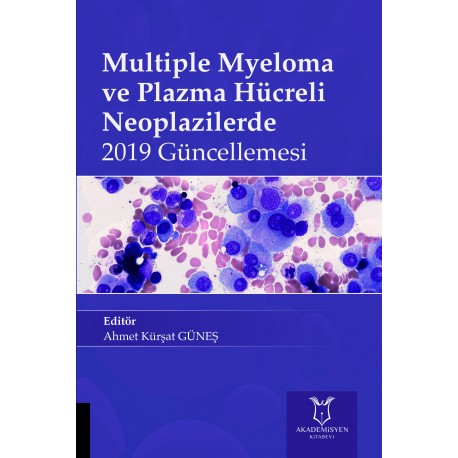 Multiple Myeloma ve Plazma Hücreli Neoplazilerde 2019 Güncellemesi