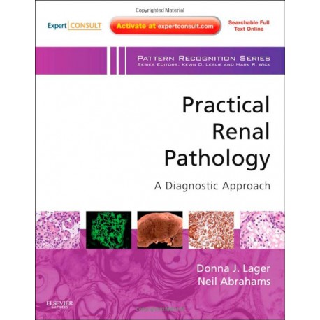 Practical Renal Pathology, A Diagnostic Approach