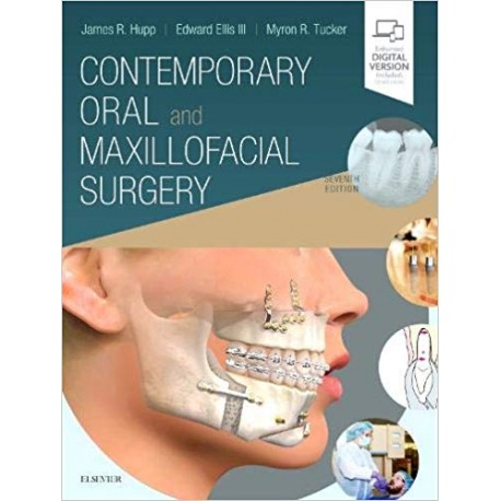 Contemporary Oral and Maxillofacial Surgery 7th Edition