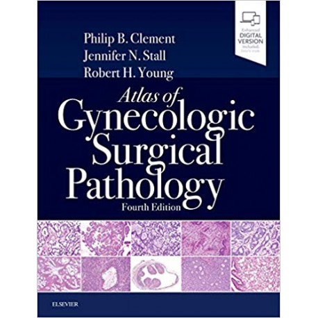 Atlas of Gynecologic Surgical Pathology, 4th Edition