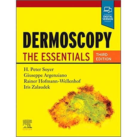 Dermoscopy: The Essentials 3rd Edition