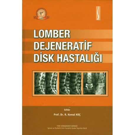 Lomber Dejeneratif Disk Hastalığı