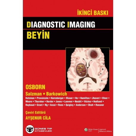 Diagnostic Imaging - Beyin, Türkçe