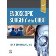 Endoscopic Surgery of the Orbit