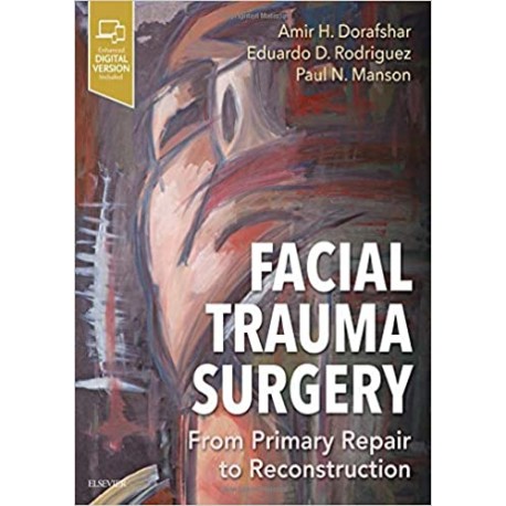 Facial Trauma Surgery From Primary Repair to Reconstruction