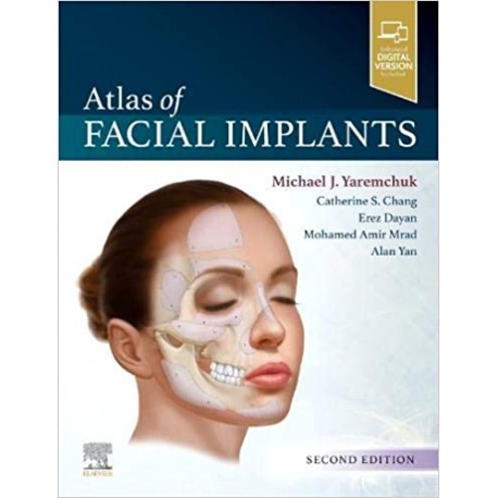 Atlas of Facial Implants, 2nd Edition