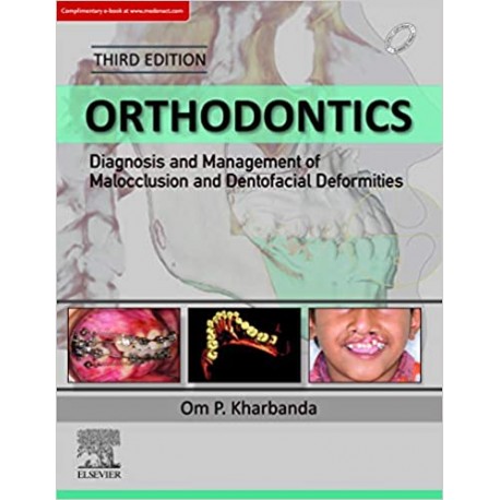 Orthodontics: Diagnosis of & Management of Malocclusion & Dentofacial Deformities