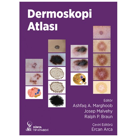 Dermoskopi Atlası