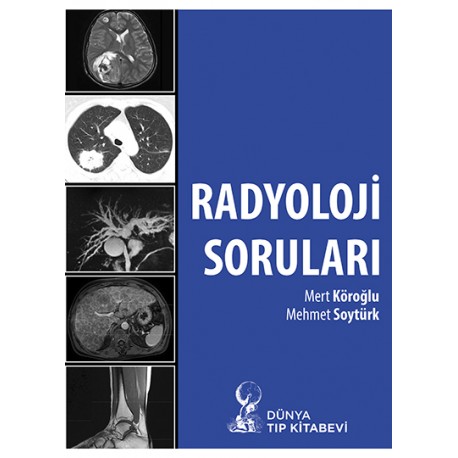 Radyoloji Soruları