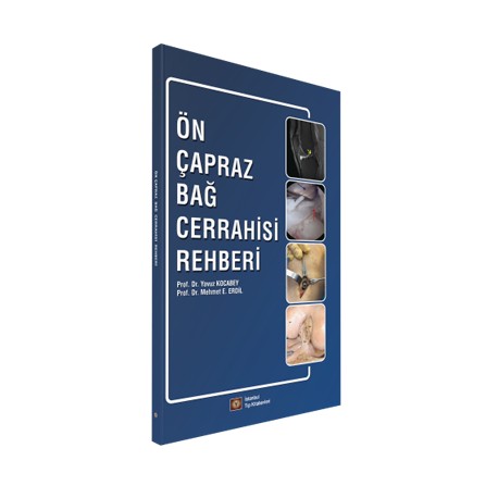 Ön Çapraz Bağ Cerrahisi Rehberi