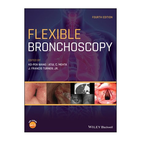 Flexible Bronchoscopy, 4th Edition