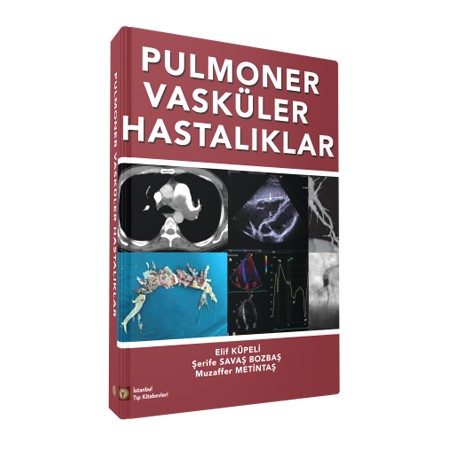 Pulmoner Vasküler Hastalıklar