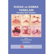 Dudak ve Damak Yarıkları 