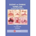 Dudak ve Damak Yarıkları