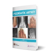 Psoriatik Artrit