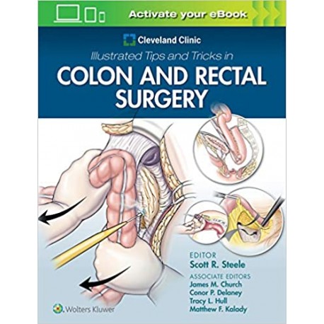 Cleveland Clinic Illustrated Tips and Tricks in Colon and Rectal Surgery