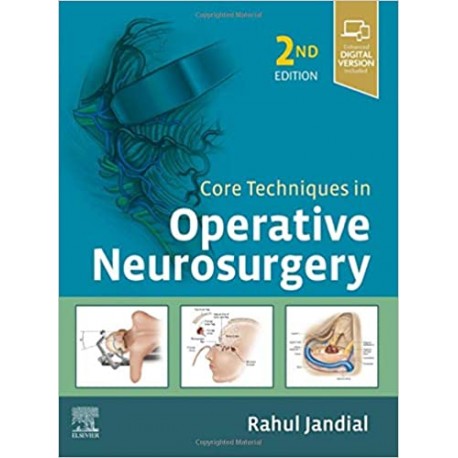 Core Techniques in Operative Neurosurgery, 2nd Edition