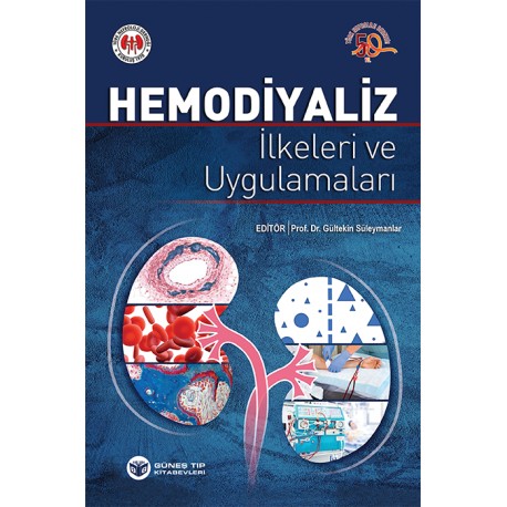 Hemodiyaliz İlkeleri ve Uygulamaları