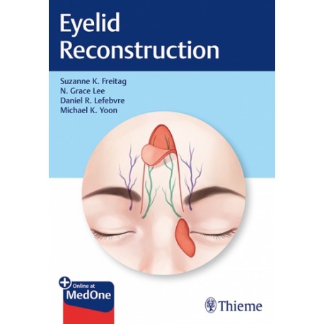 Eyelid Reconstruction