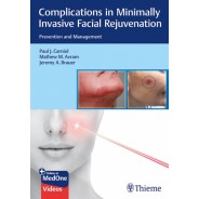Complications in Minimally Invasive Facial Rejuvenation