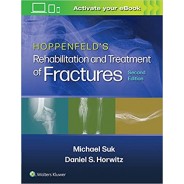 Hoppenfeld's Treatment and Rehabilitation of Fractures