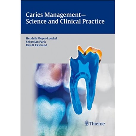 Caries Management - Science and Clinical Practice