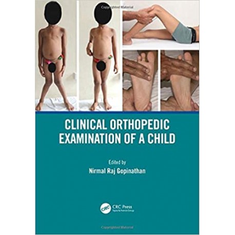 Clinical Orthopedic Examination of a Child Clinical Orthopedic Examination of a Child