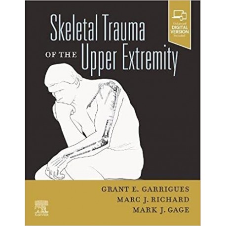 Skeletal Trauma of the Upper Extremity