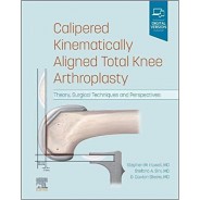 Calipered Kinematically aligned Total Knee Arthroplasty