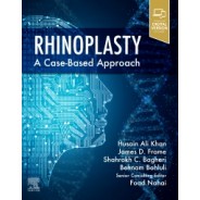 Rhinoplasty a Case-based approach