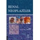 Renal Neoplaziler