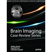 Brain Imaging (Case Review)