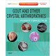 Gout & Other Crystal Arthropathies