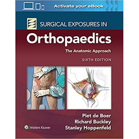 Surgical Exposures in Orthopaedics: The Anatomic Approach