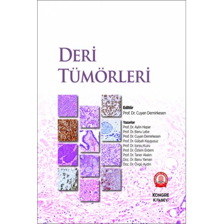 Deri Tümörleri