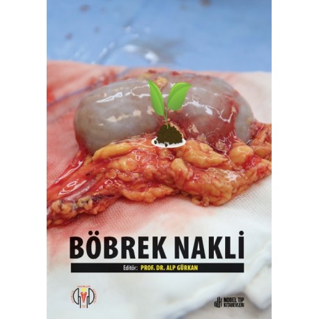 Böbrek Nakli