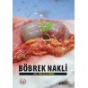 Böbrek Nakli