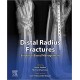 Distal Radius Fractures Evidence-Based Management