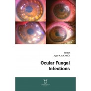 Ocular Fungal Infections
