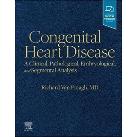 Congenital Heart Disease