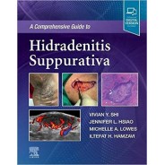 A Comprehensive Guide to Hidradenitis Suppurativa