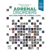 Adrenal Disorders 100 Cases from the Adrenal Clinic