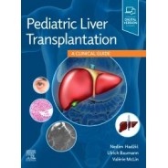 Pediatric Liver Transplantation