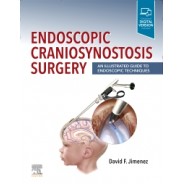 Endoscopic Craniosynostosis Surgery