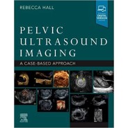 Pelvic Ultrasound Imaging