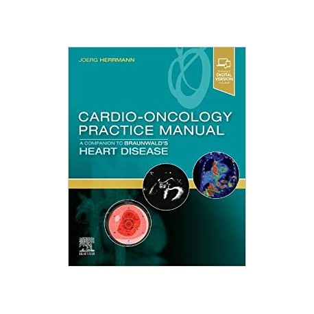 Cardio-Oncology Practice Manual: A Companion to Braunwald’s Heart Disease