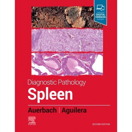 Diagnostic Pathology: Spleen, 2nd Edition