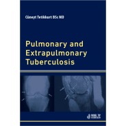Pulmonary and Extrapulmonary Tuberculosis
