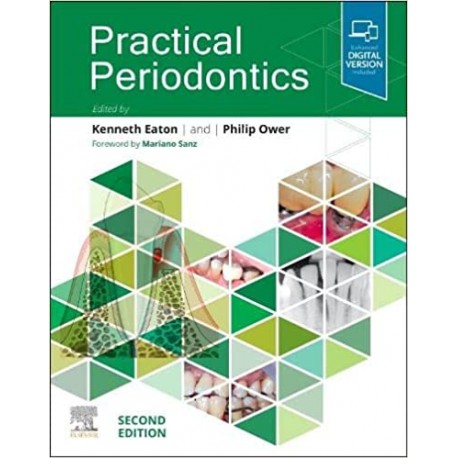 Practical Periodontics