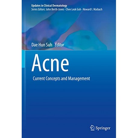 Acne Current Concepts and Management